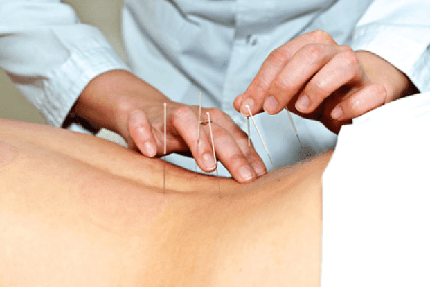 acupuncture pour l'alcoolisme